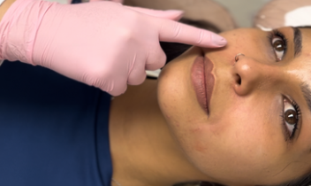 Estética Regenerativa